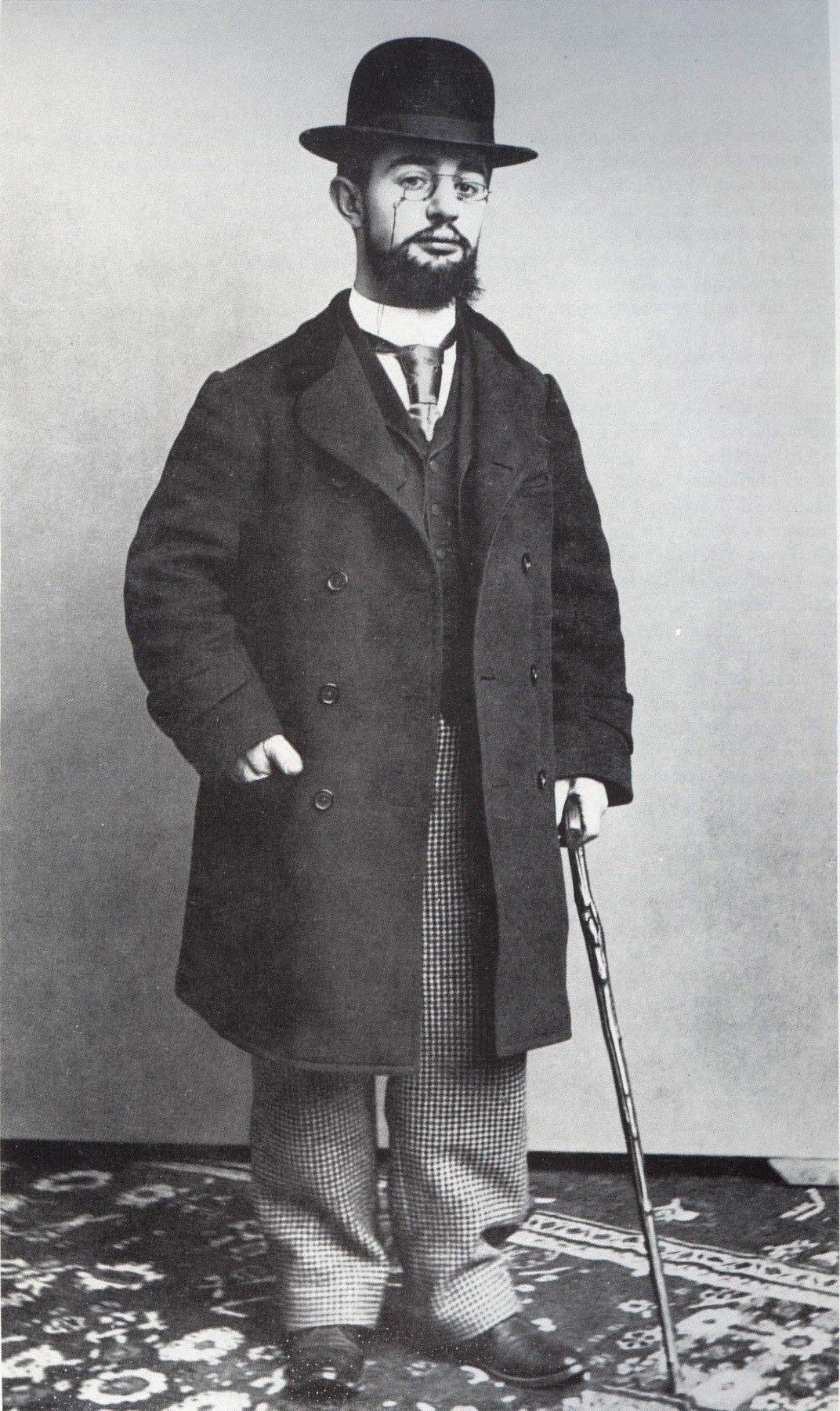 A photograph of Henri de Toulouse-Lautrec.